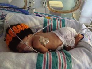 Baby Vivian is one month old and weighs 2 pounds.  Please pray for her.  